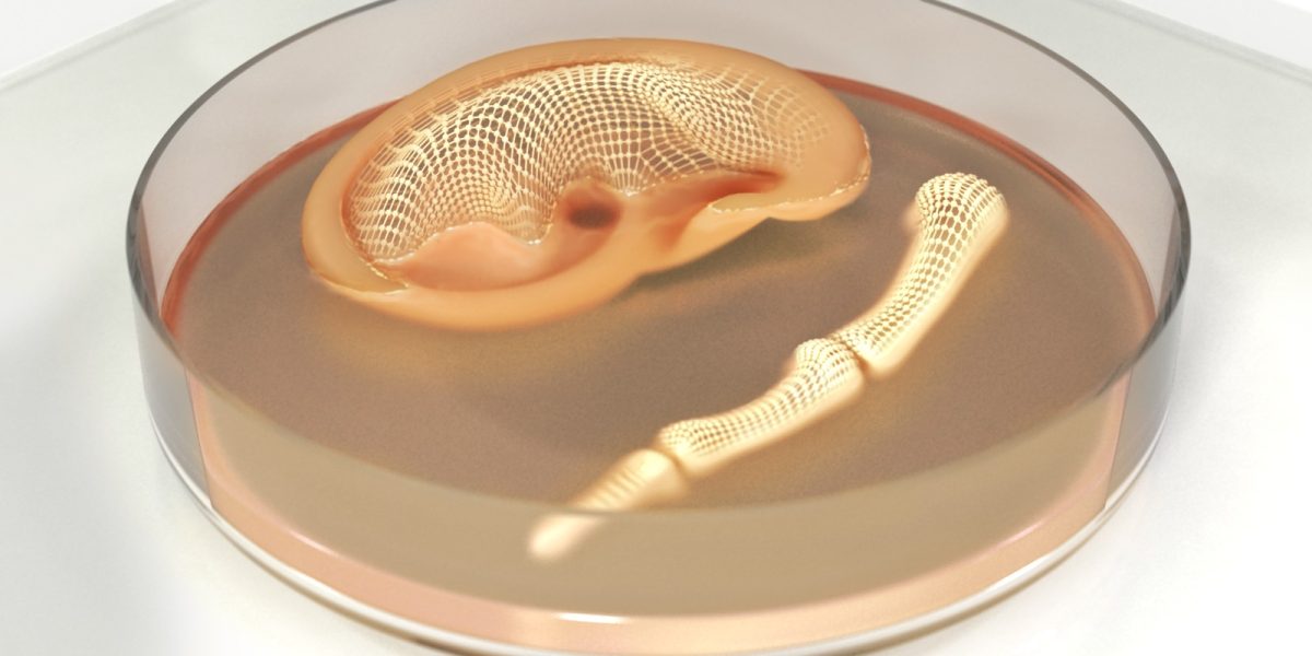 Bio-printing